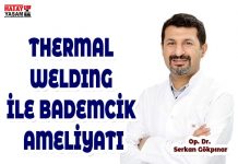 THERMAL WELDING İLE BADEMCİK AMELİYATI